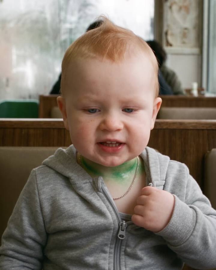 Toddler with a green ring round his neck from a cheap chain
